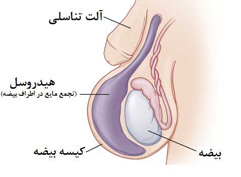 هیدروسل