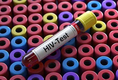 ایدز hiv